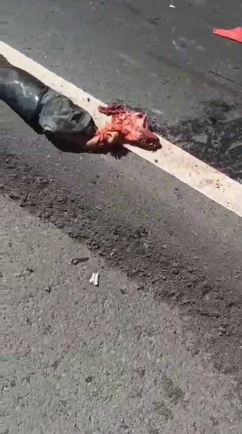 The Dude Doesn’t Need His Leg Or His Boot Because He’s Dead