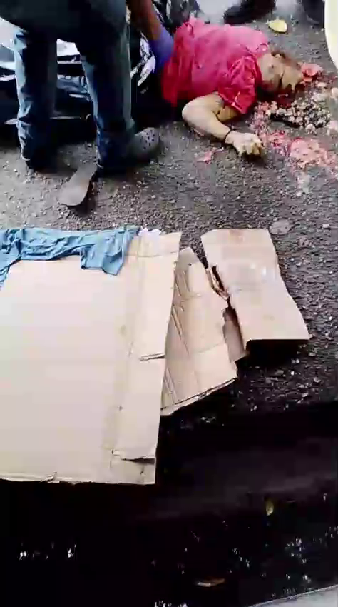 A Woman’s Skull Is Completely Destroyed After A Car Drives Over It