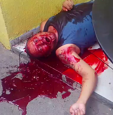 Two Assailants Fatally Wounded A 46-Year-old Man And Robbed Him