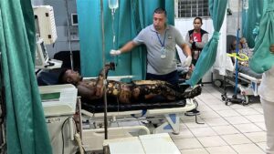 Biker Crashed & Caught On Fire