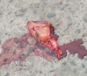 Dead Motorcyclist And His Still Beating Heart 3 Dead Motorcyclist And His Still Beating Heart