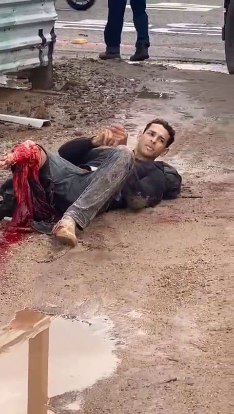 A Lost Leg Is Not A Reason To Miss An Important Call