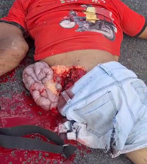 A 24-Year-old Motorcyclist Died While Trying To Get Ahead Of His Friend. Aftermath