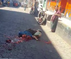 Truck Runs Over Woman's Skull In Santiago Atitlan. Aftermath 1 Truck Runs Over Woman's Skull In Santiago Atitlan. Aftermath