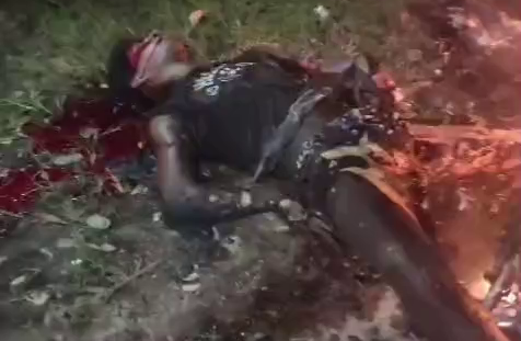 A 30-Year-Old Motorcyclist Was Burned Alive, And His 25-Year-Old Passenger Suffered Severe Third-degree Burns