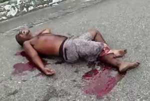 Dude Is Almost Crying, He Feels Sorry For His Lost Leg