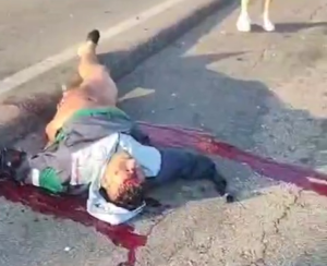 After The Accident, The Motorcyclist Remained Only A Dick And One Leg