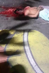 This Is What A Human Head Looks Like After Being Hit By 50 Bullets 1 This Is What A Human Head Looks Like After Being Hit By 50 Bullets