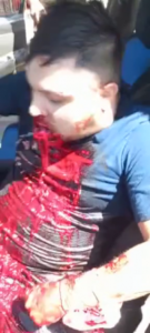 A Brave Woman Tried To Detain The Killers Who Shot Her Husband 1 A Brave Woman Tried To Detain The Killers Who Shot Her Husband