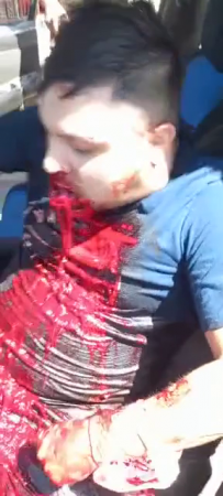 A Brave Woman Tried To Detain The Killers Who Shot Her Husband