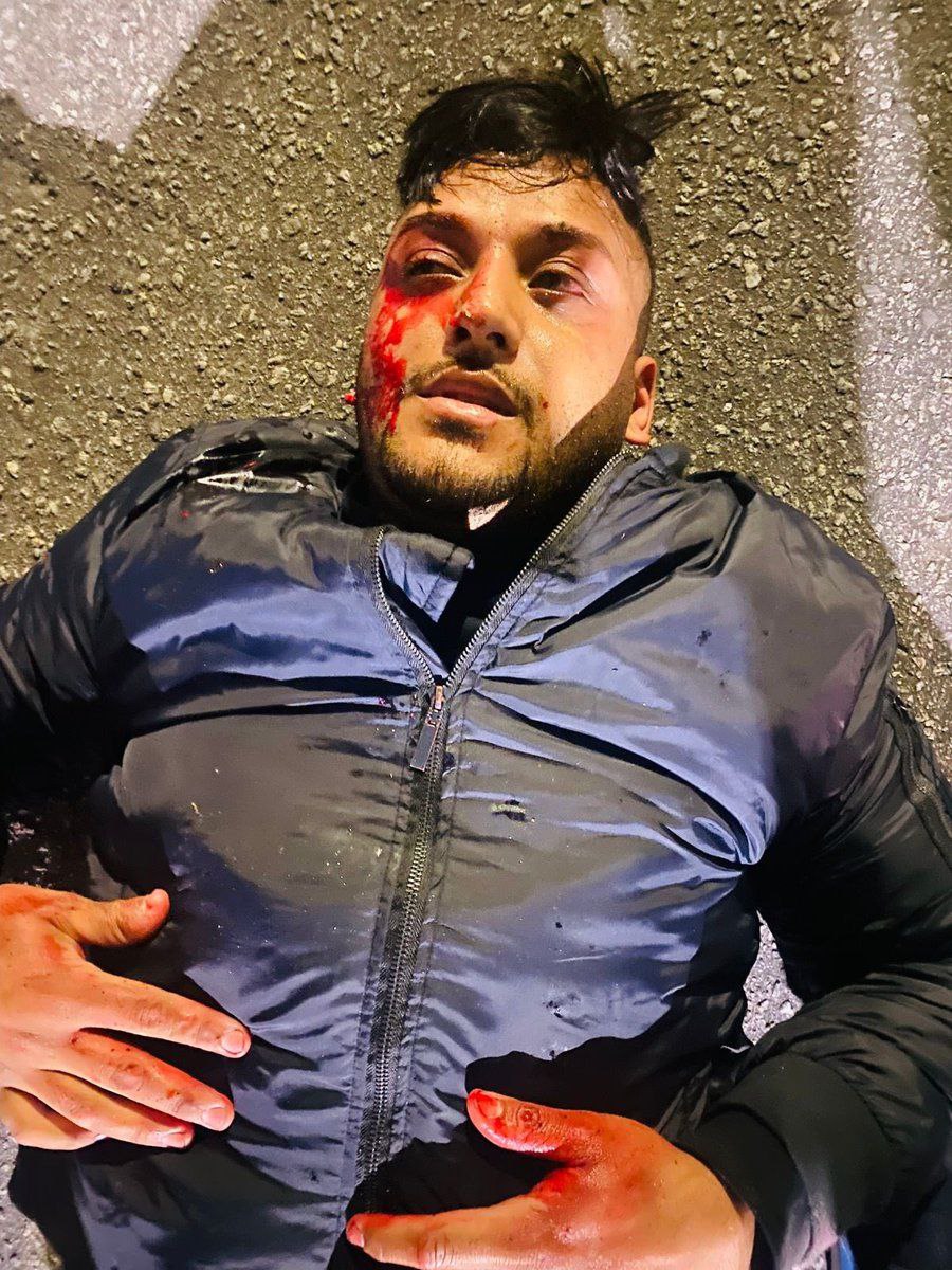 A Woman Wounded A Robber Who Stole Her Husband’s Phone With A Pistol