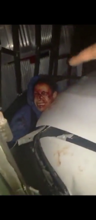 A Woman Was Crushed By A Car Against The Wall Of A Criminal Who Was Trying To Rob Her. Colombia