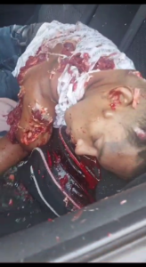 Probably Shot The Man's Skull Off With A Shotgun Blast 1 Probably Shot The Man's Skull Off With A Shotgun Blast