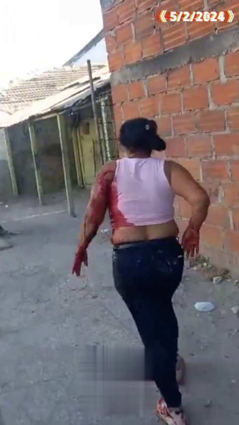 Badly Wounded Wife Defending Arrested Husband After Stabbing Her