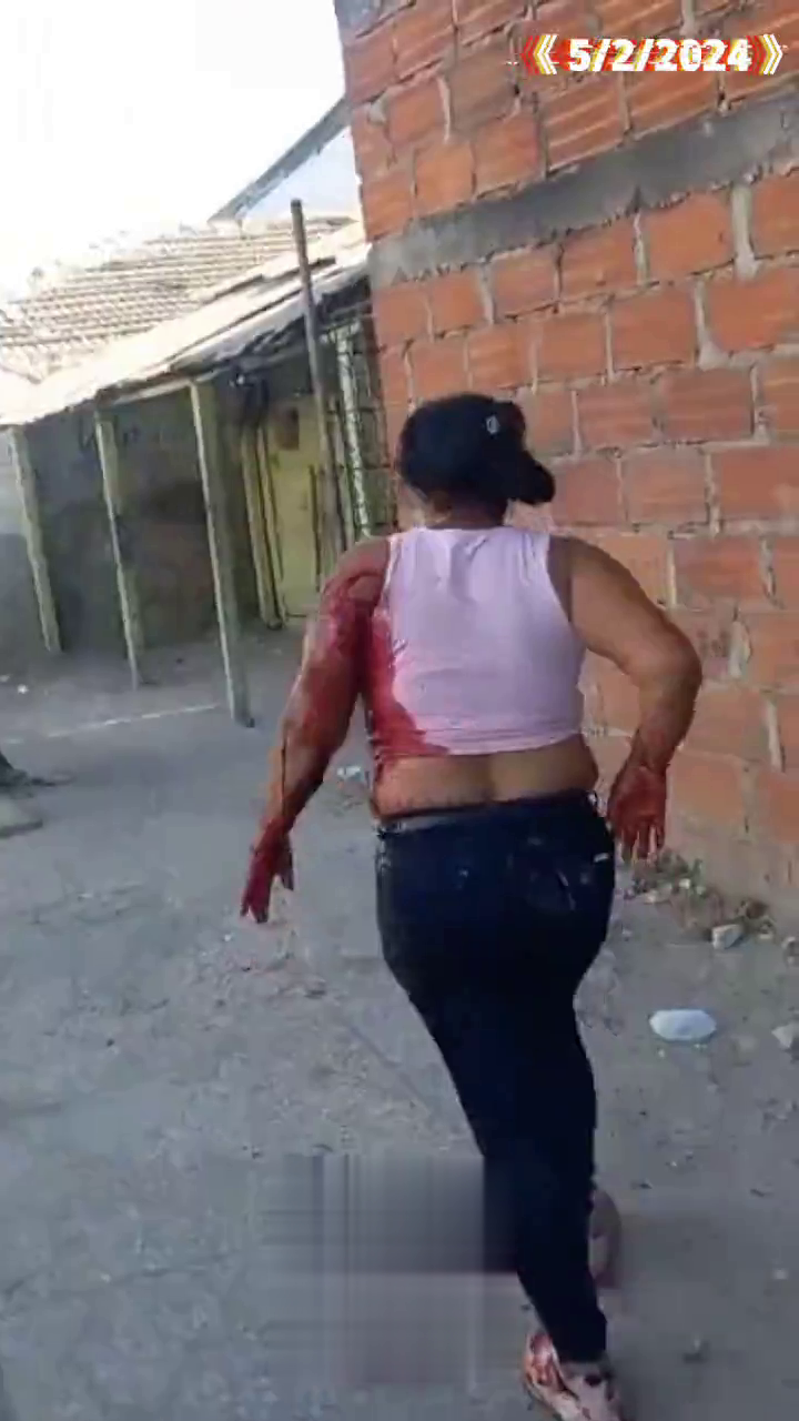 Badly Wounded Wife Defending Arrested Husband After Stabbing Her