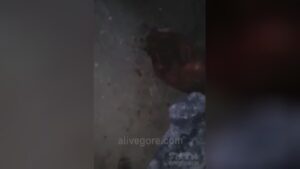 A man was actually chance and stuck along with a pickaxe in his scalp 1 A man was actually chance and stuck along with a pickaxe in his scalp