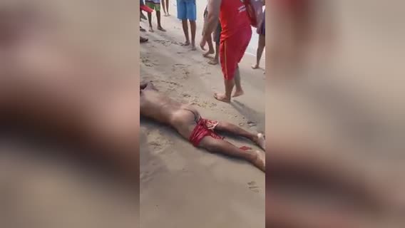 After-effects of shark attack