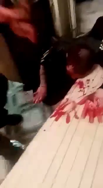 Consequences Of A Drunken Brawl Between Two Drunken Freaks In Russia