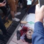 Bullet In The Head Part Of The Scalp On The Pavement