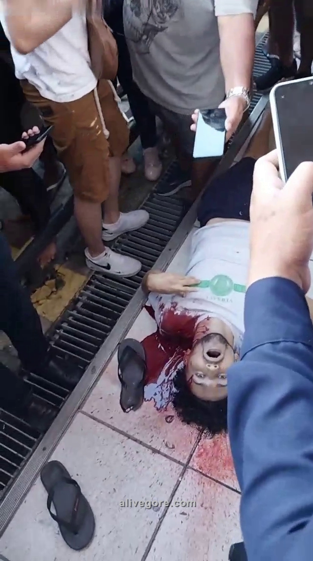 Bullet In The Head Part Of The Scalp On The Pavement