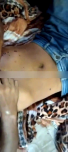 The Man's Skull Turned To Dust After The Shot From The Gun. Aftermath