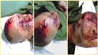 Dismal Russkie Tried Blow His Brains Out—It Failed! | 18+